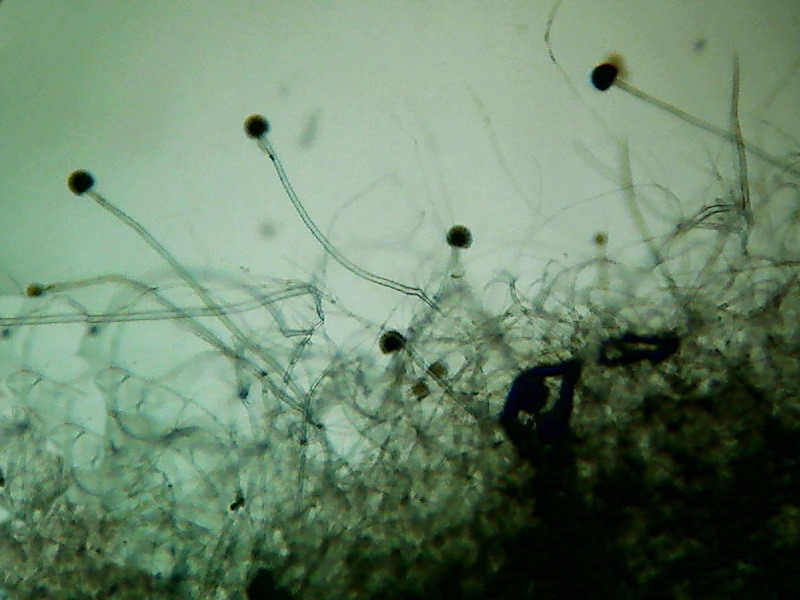 Aspergillus 1