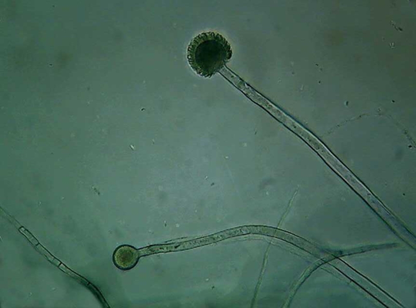 aspergillus 2