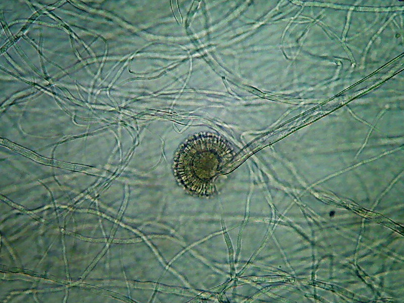 Aspergillus 3