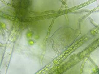 Vorticella