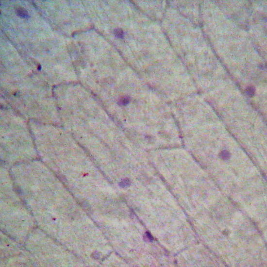 onion epithelium