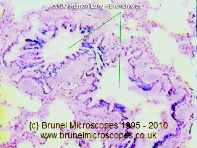 Human Respiratory System Lung Tuberculosis Microscope Slide 