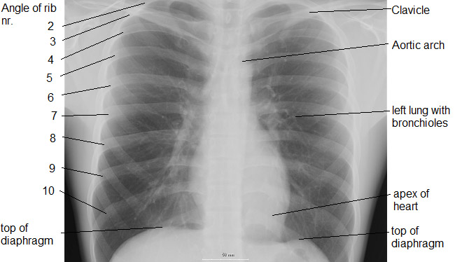 Anatomy at Microscopy-UK: Human Lungs