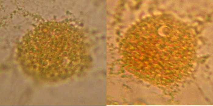 two nuclei iodine