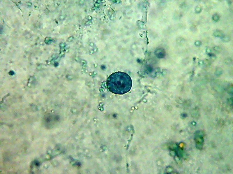 bladder nuclei 1