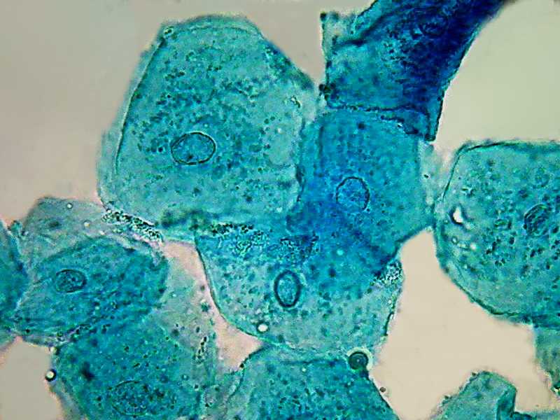 Cheek cells 100x