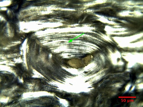 Bovine osteon in polarized light