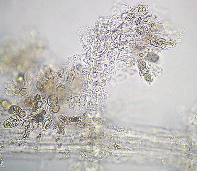 Batrachospermum carposporangia