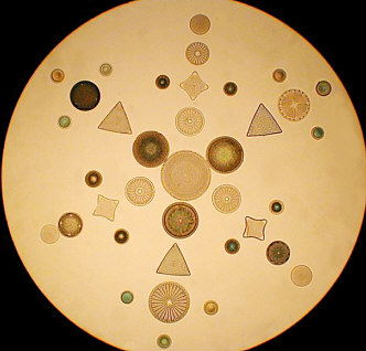 Low power with closed iris to colour diatoms