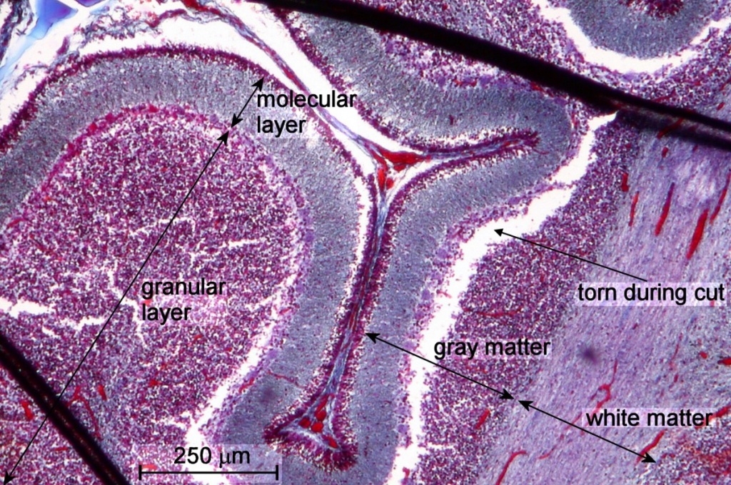 Nervous Tissue Under Microscope - Micropedia