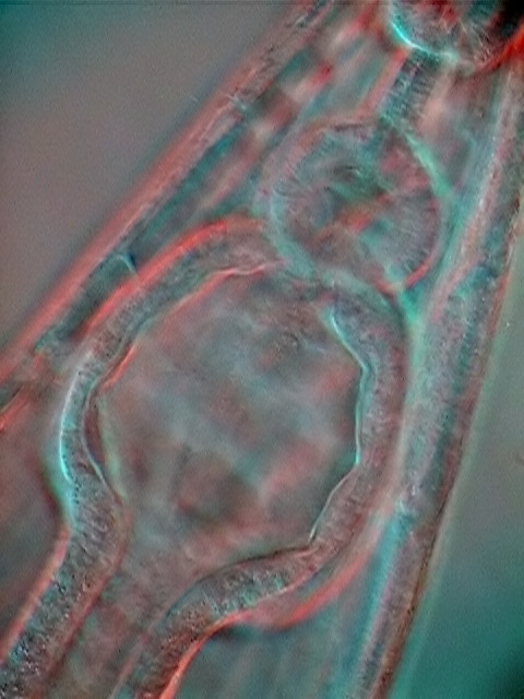 gastric pouch 08-hammer