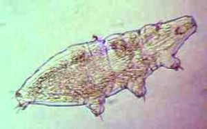 Tardigrade from West Orange, NJ