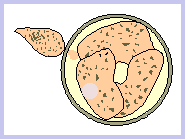 2nd <em>Colpoda</em> gets out