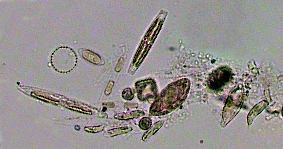 microplancton