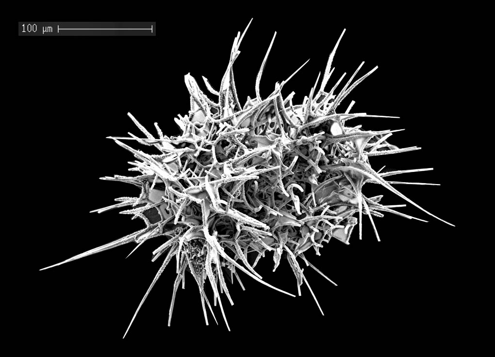 Mic-UK: Help identify these microfossils.