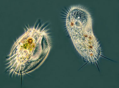 ciliates under microscope