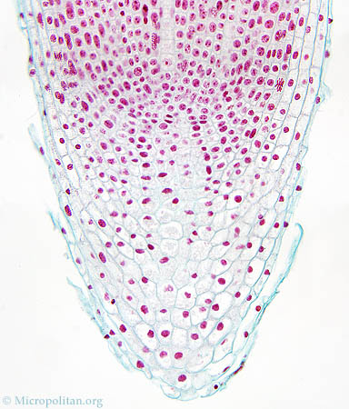 In the cells of the root tip of an onion chromosomes can be made visible 