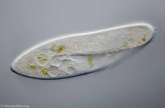 ciliates under microscope