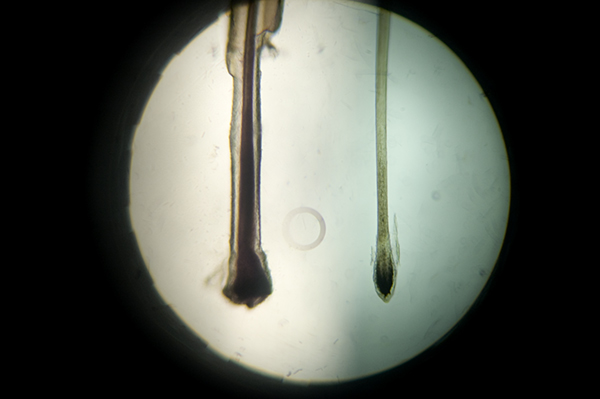 Hair through the microscope.