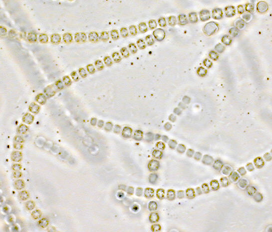 Nostoc Under Microscope Labelled