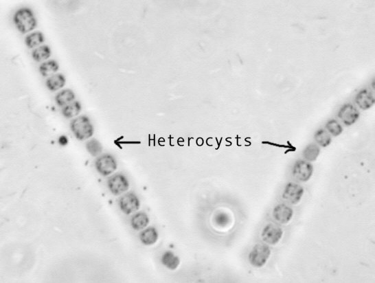 Nostoc Under Microscope Labelled